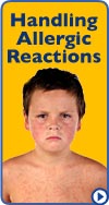 Handling Allergic Reactions