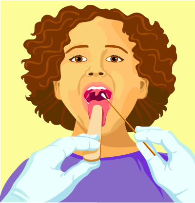 喉咙里的DNA
